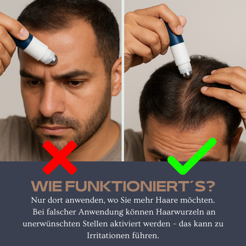 CROWNA GROW® - Roll-On Haarwuchs Serum