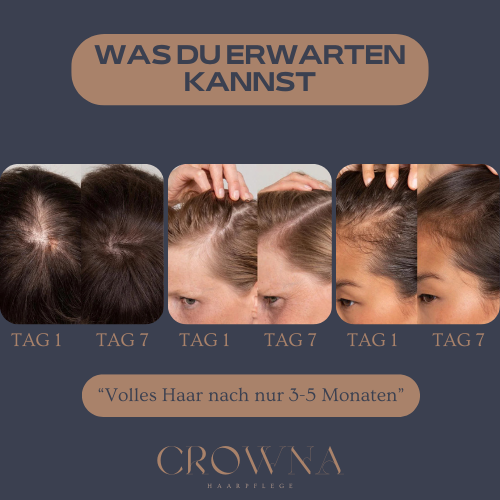 CROWNA GROW® - Roll-On Haarwuchs Serum