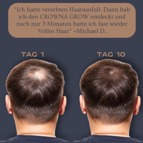CROWNA GROW® - Roll-On Haarwuchs Serum