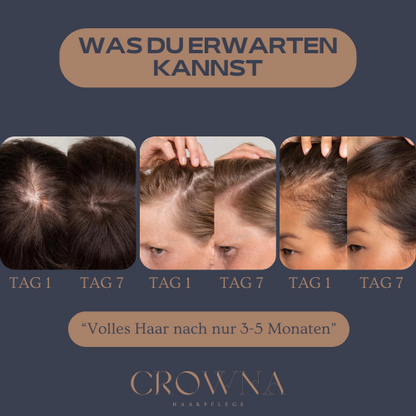 CROWNA GROW® - Roll-On Haarwuchs Serum